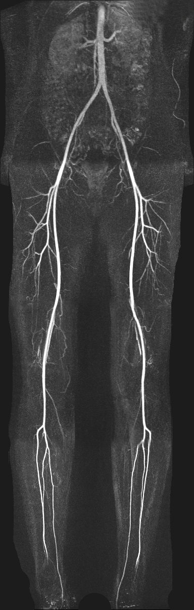 ct becken bein angiographie ebm