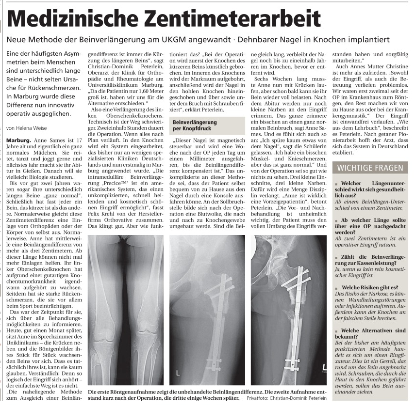 Oberhessische Presse vom 03.09.2013 - Deformitätenkorrektur